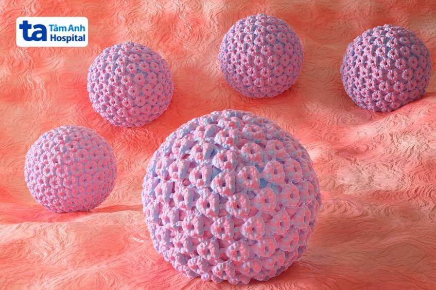 cắt u nhú ống hậu môn