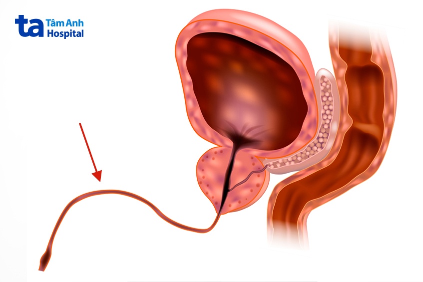 cấu tạo của niệu đạo