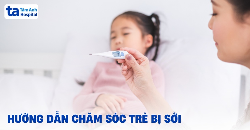 Hướng dẫn cách chăm sóc trẻ bị sởi tại nhà đơn giản mà hiệu quả