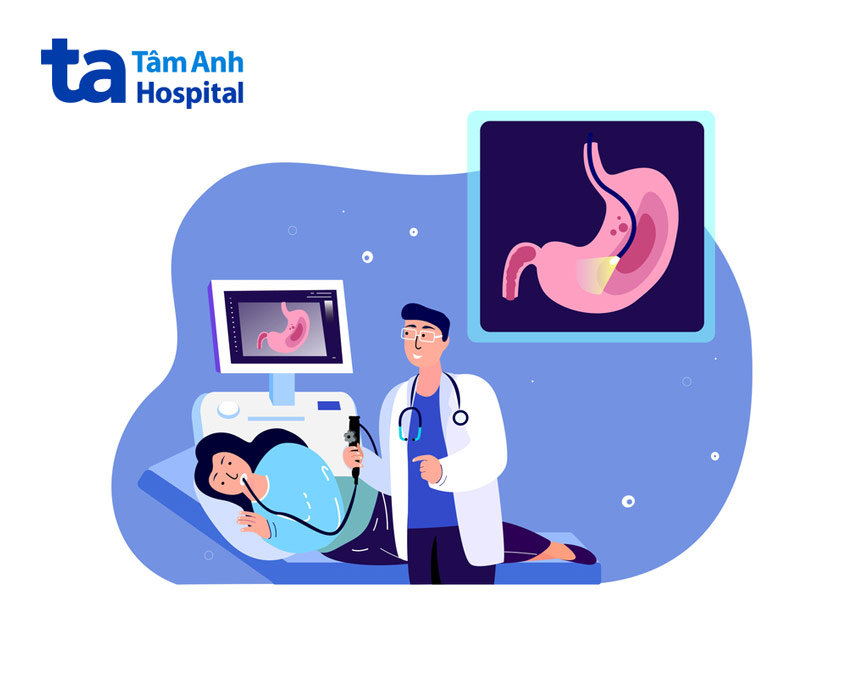 chẩn đoán ung thư dạ dày phổ biến nhất hiện nay là nội soi dạ dày