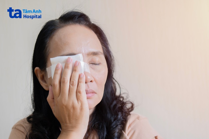 chấn thương mắt gây glocom thứ phát