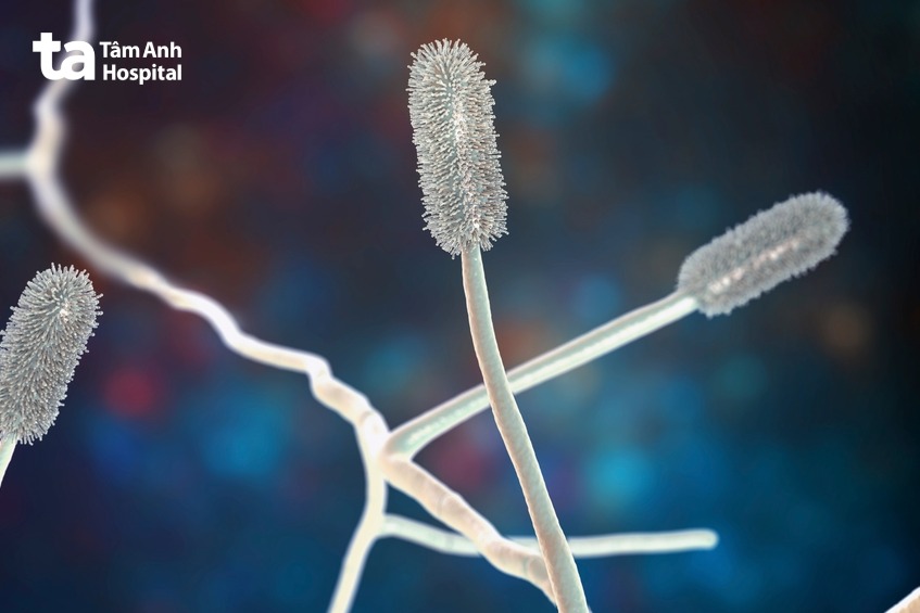 chữa nấm ống tai ngoài