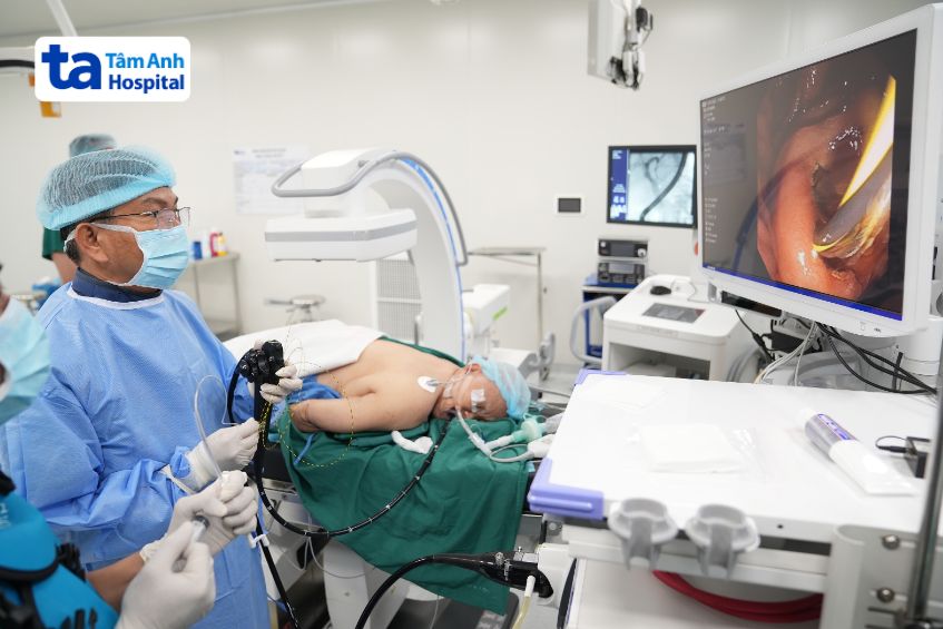 chữa viêm tụy mạn