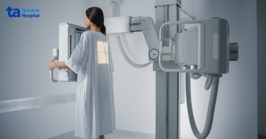 chụp x quang ngực chẩn đoán nguyên nhân gây viêm mô mỡ