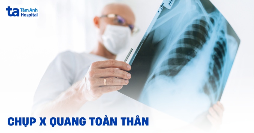Chụp X quang toàn thân: Đối tượng, chẩn đoán bệnh gì và quy trình