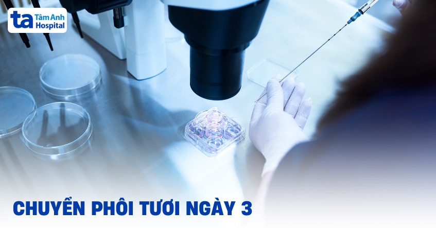 Chuyển phôi tươi ngày 3: Quy trình, chỉ định, thời điểm và rủi ro