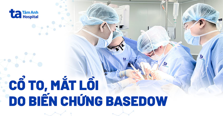 Cổ to, mắt lồi do biến chứng bệnh Basedow