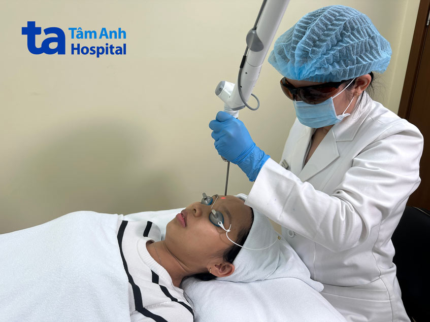 công nghệ laser phá vỡ những hạt sắc tố melanin hoặc bốc bay lớp tế bào sừng chứa sắc tố trên cùng