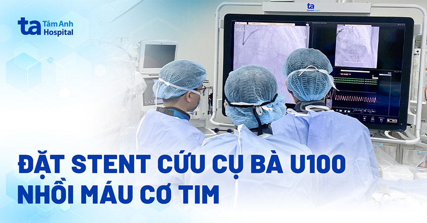 Cụ bà U100 được nong mạch máu tim thành công