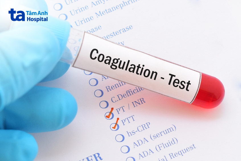 đánh giá các nguy cơ về đông máu