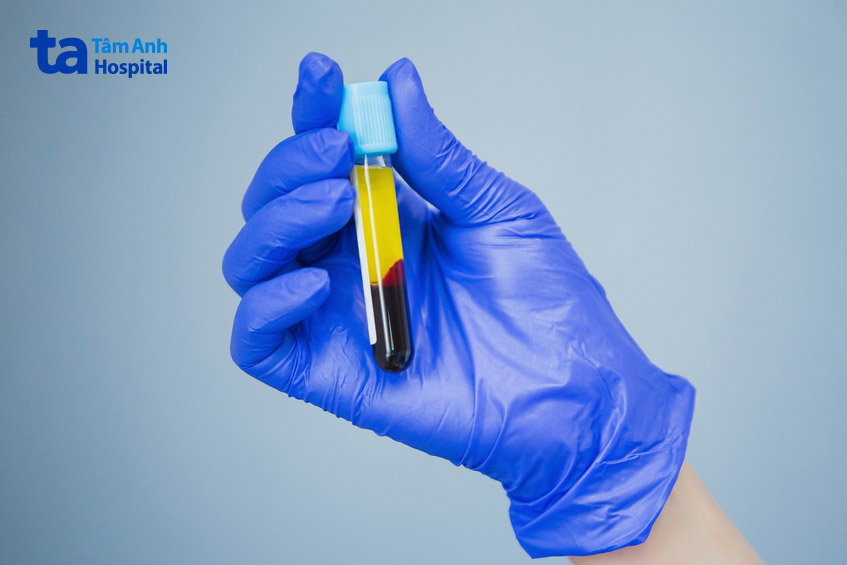 đánh giá khả năng đông máu