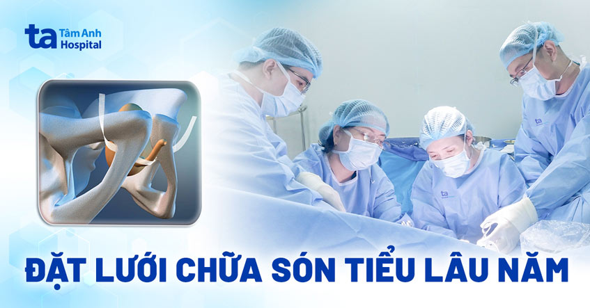 Đặt lưới chữa són tiểu lâu năm