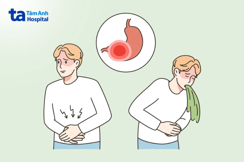 dấu hiệu của ung thư dạ dày giai đoạn 3