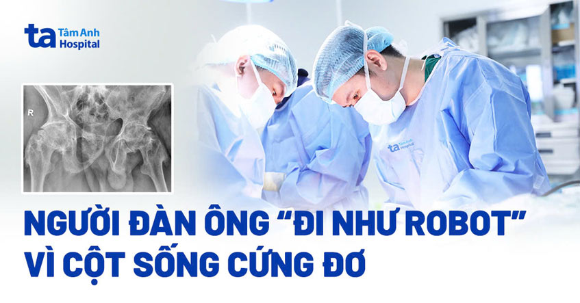Người đàn ông ‘đi như robot’ vì cột sống cứng đơ