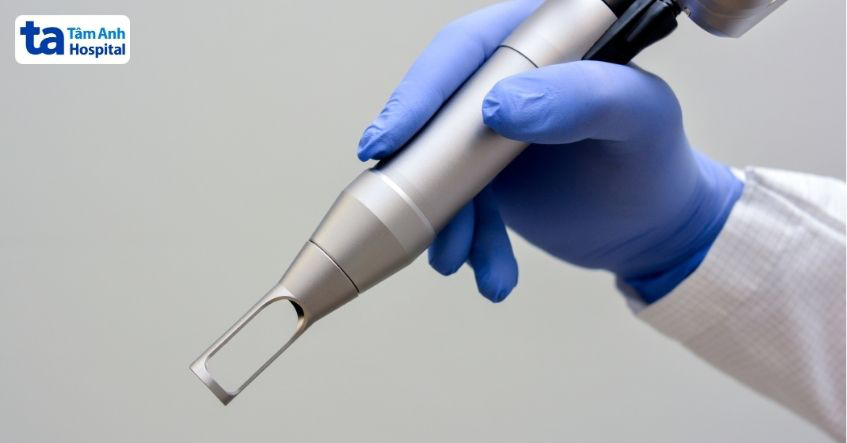 điều trị bướu máu bằng laser được chỉ định với các bướu máu nhỏ