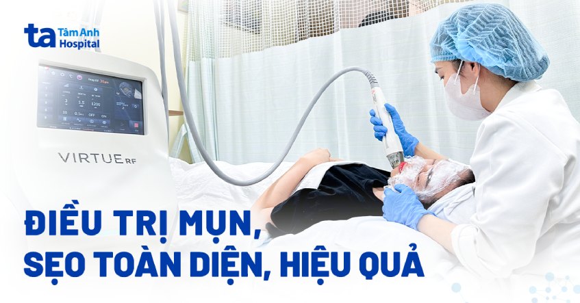 điều trị mụn và sẹo toàn diện livestream