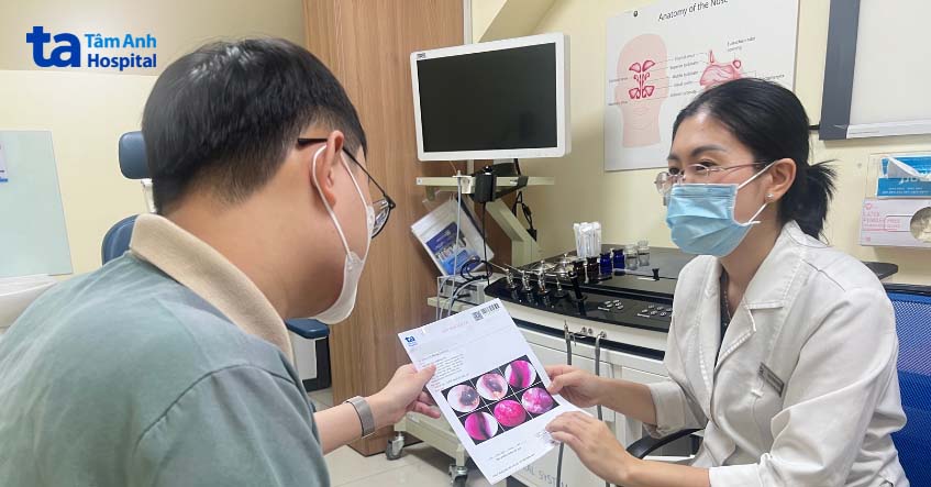 điều trị sổ mũi