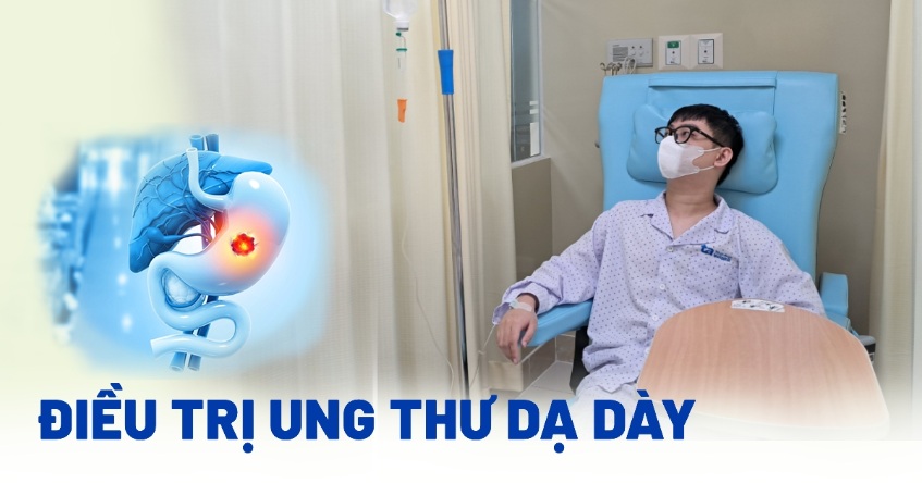 điều trị ung thư dạ dày