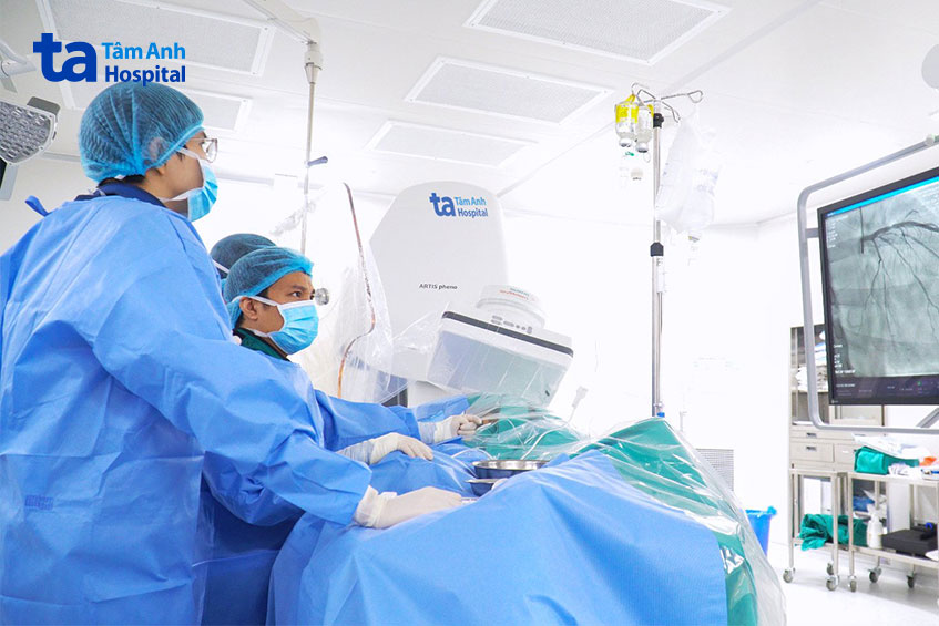 Ekip bác sĩ thực hiện can thiệp đặt stent cho bệnh nhân nhồi máu cơ tim