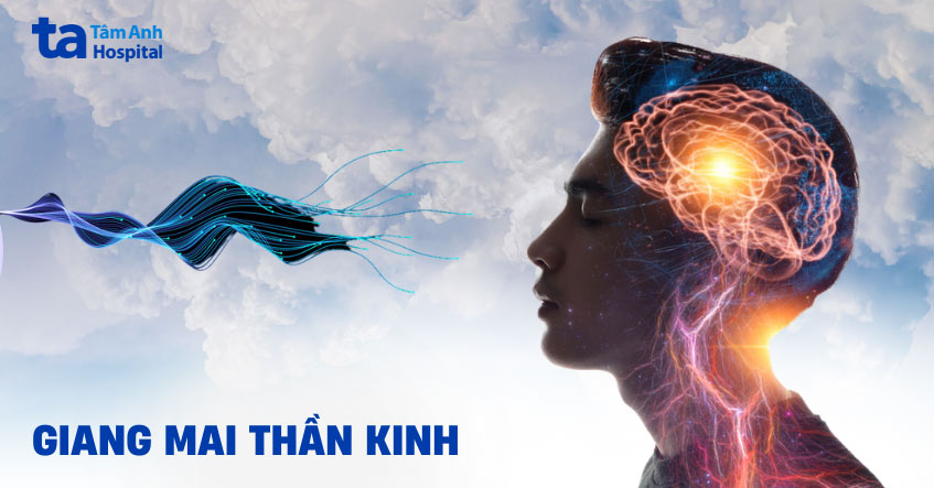 Giang mai thần kinh: Nguyên nhân, triệu chứng và cách điều trị