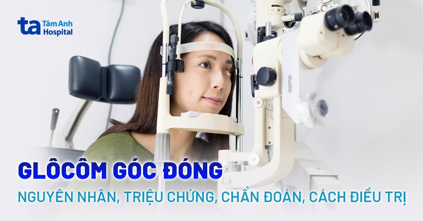 Glocom góc đóng là gì? Nguyên nhân, triệu chứng và cách điều trị