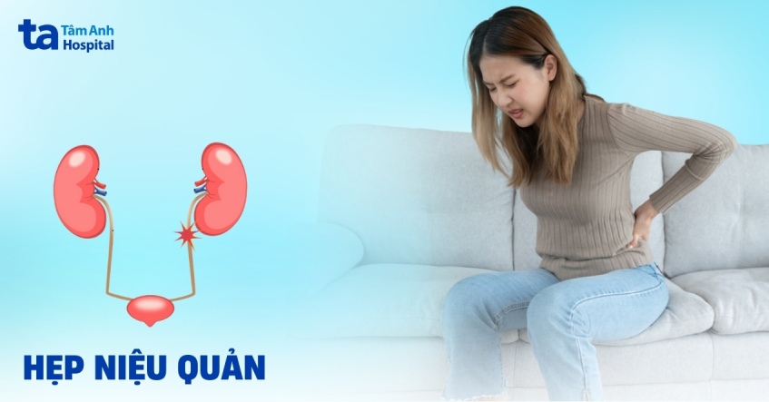 Hẹp niệu quản: Nguyên nhân, triệu chứng, chẩn đoán, phòng ngừa