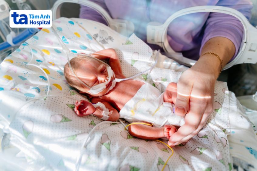 Hình ảnh chăm sóc cho em bé sinh non 27 tuần