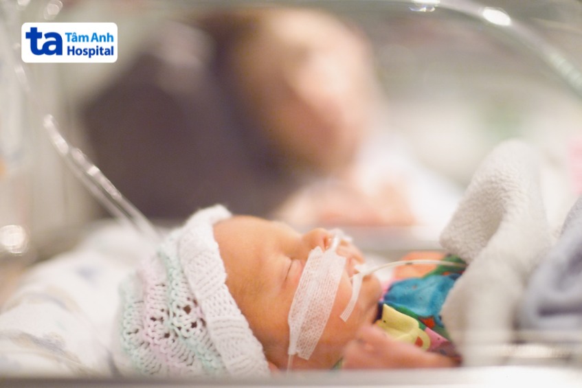 Hình ảnh chăm sóc em bé sinh non 31 tuần tuổi