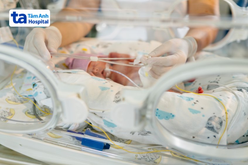 Hình ảnh em bé sinh non 31 tuần tuổi nằm trong lồng ấp