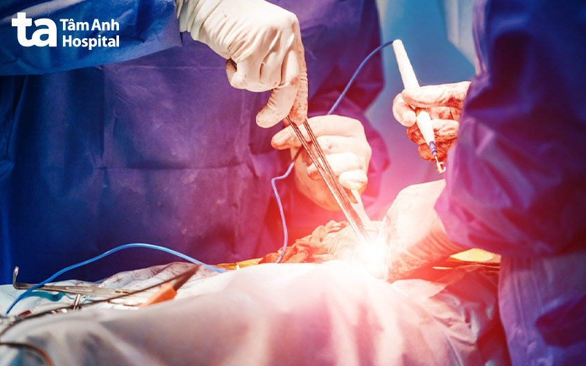 Hở van động mạch chủ nặng cần được phẫu thuật để sửa chữa hoặc thay van tim