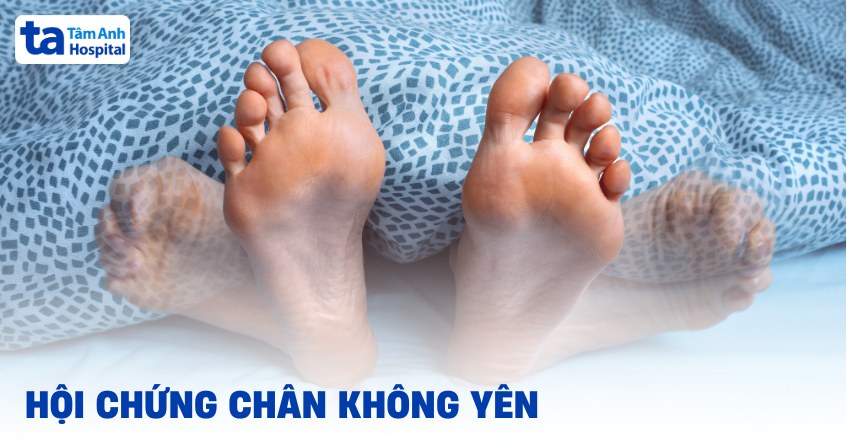 hội chứng chân không yên
