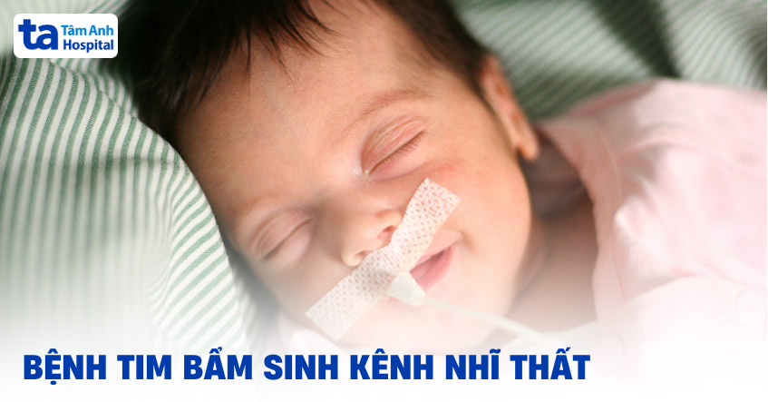Kênh nhĩ thất là gì?