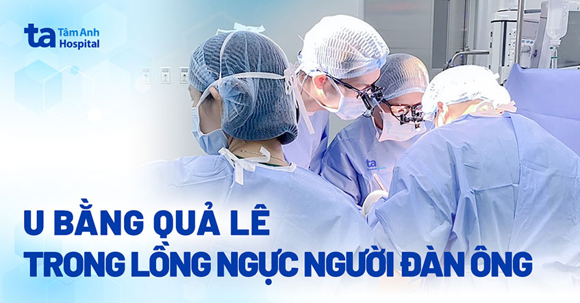 Khám viêm xoang phát hiện u lồng ngực to bằng quả lê 