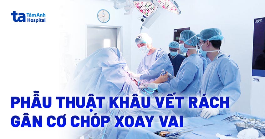 khâu vết rách gân cơ chóp xoay