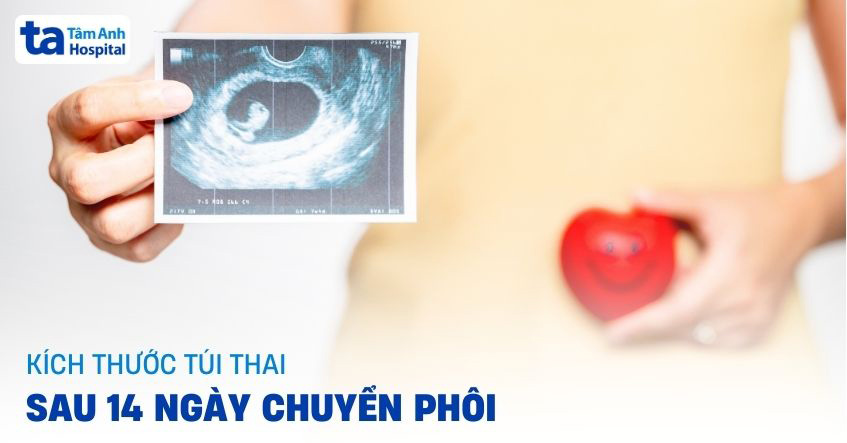 Kích thước túi thai sau 14 ngày chuyển phôi đã phát triển chưa?