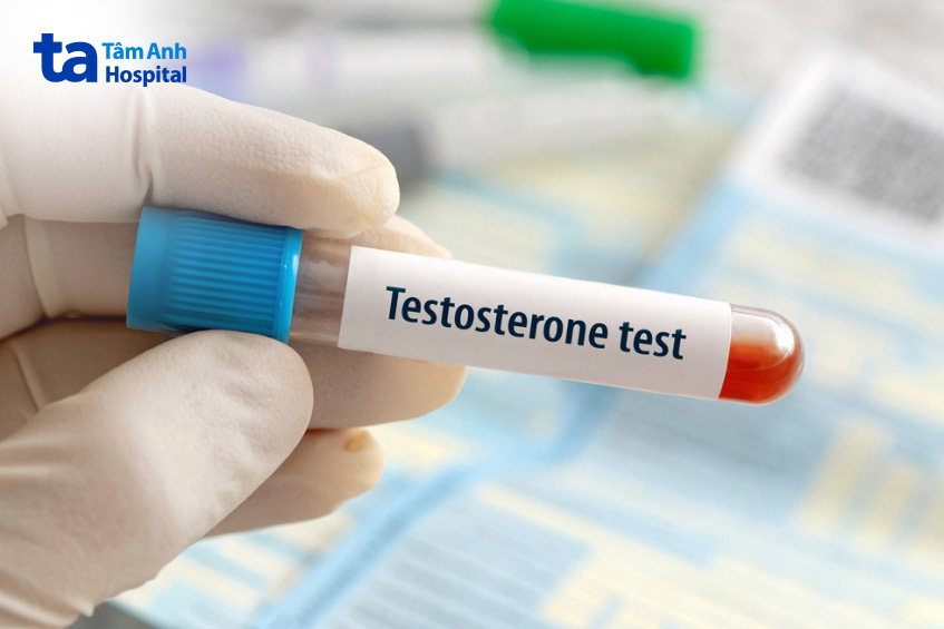 kiểm tra nồng độ testosterone thông qua xét nghiệm máu
