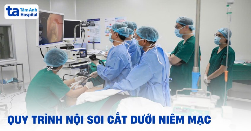 Nội soi cắt dưới niêm mạc: Quy trình, lợi ích và rủi ro