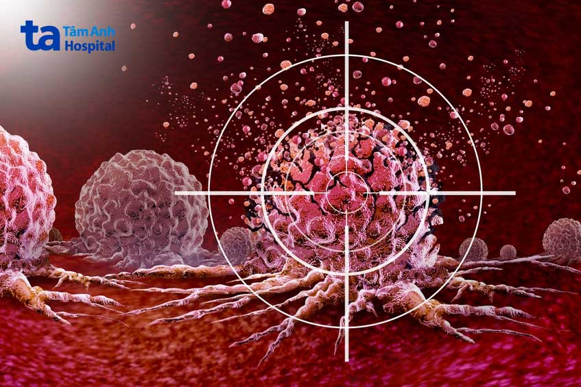 liệu pháp đích tấn công điều trị ung thư dạ dày
