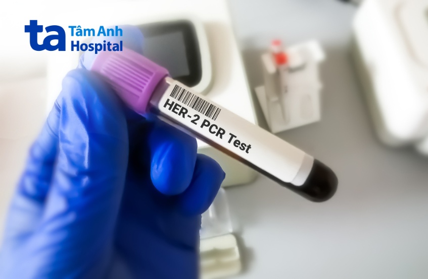 liệu pháp tân bổ trợ khi điều trị ung thư vú
