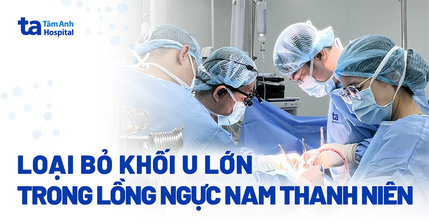 Mạng nhện tĩnh mạch bao vây u trung thất