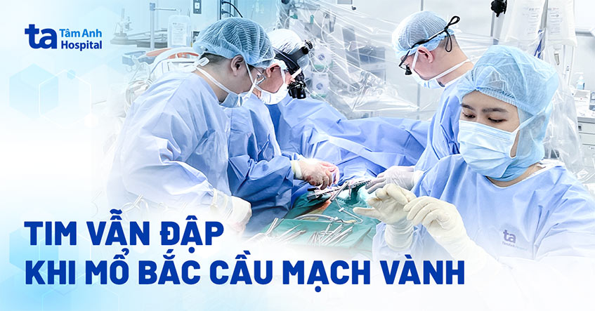 Mổ bắc cầu mạch vành khi trái tim vẫn đập