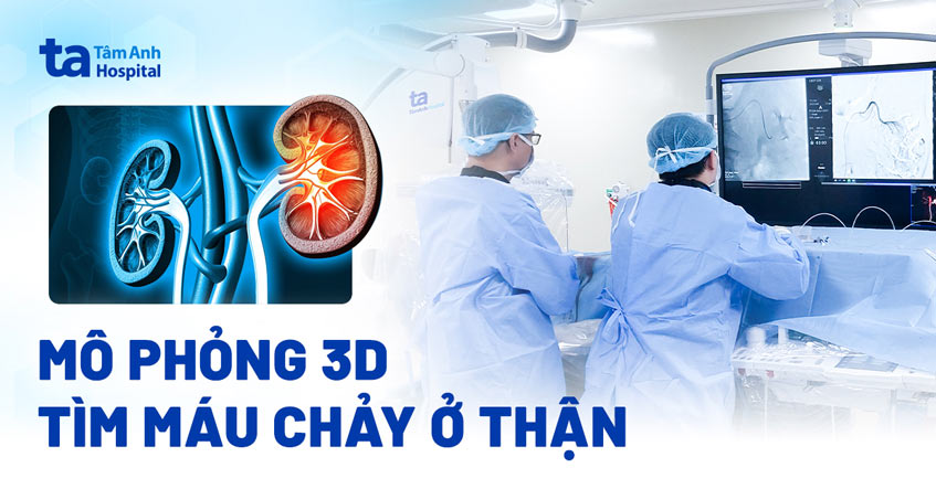 mô phỏng 3d tìm máu chảy ở thận