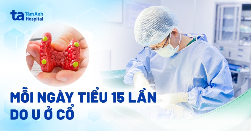 mỗi ngày đi tiểu 15 lần do u ở cổ