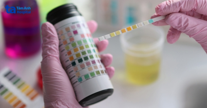 một số loại thực phẩm thay đổi màu sắc và ph trong nước tiểu