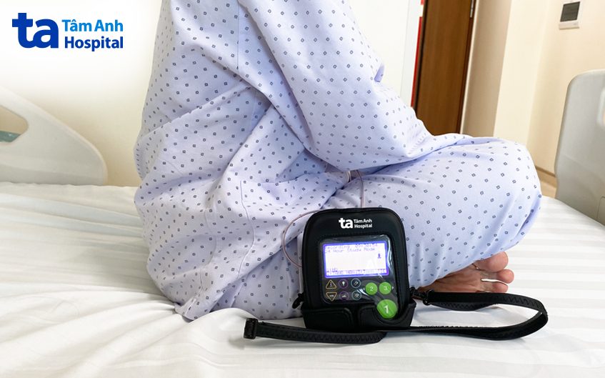 người bệnh đo pH 24h