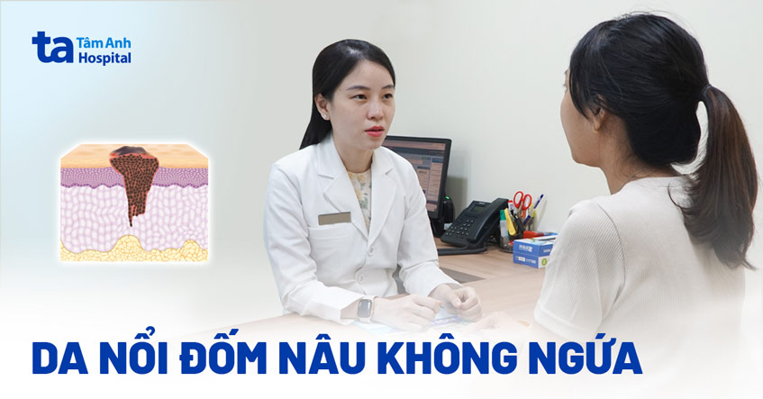 Da nổi đốm nâu không ngứa có ảnh hưởng tới sức khỏe không?