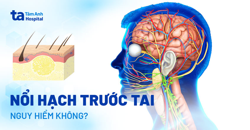 Nổi hạch trước tai có nguy hiểm không? Nguyên nhân và dấu hiệu
