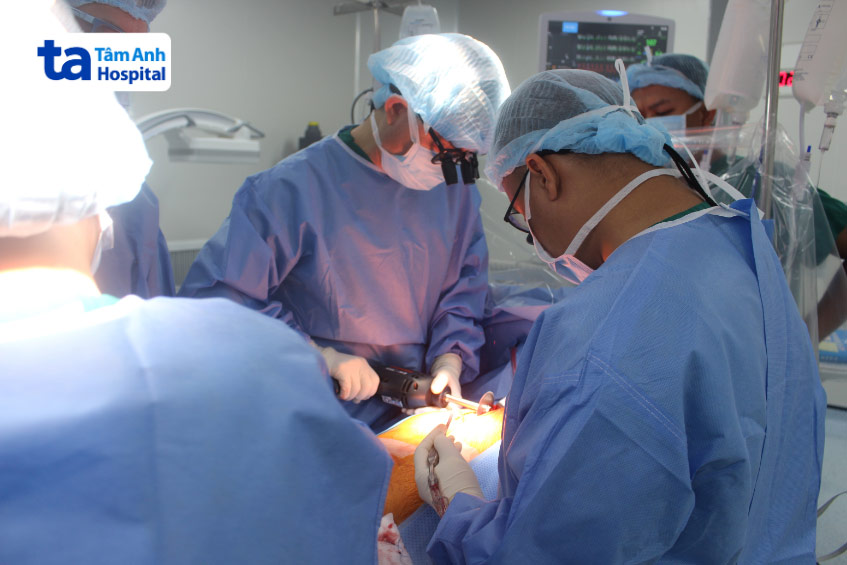 Phẫu thuật bắc cầu động mạch cho bệnh nhân bị suy tim do hẹp động mạch vành nặng