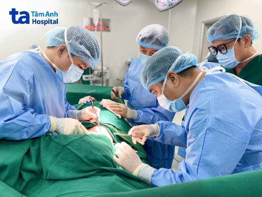 phẫu thuật kéo đầu ngực