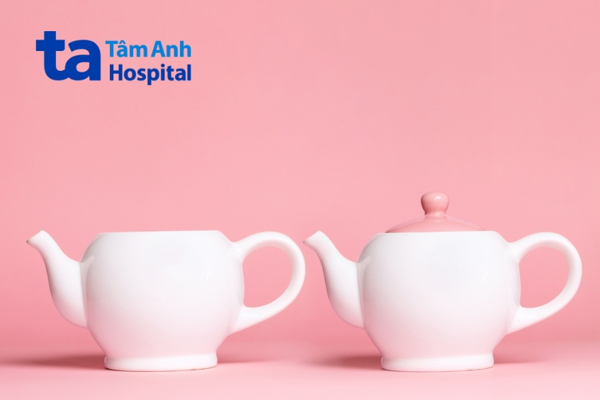 phẫu thuật kéo núm vú